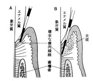 BOP(+)とは？