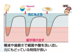 歯の周りに菌が住み着いており、共存している集合体を「マイクロビオーム」といいます。  その中には良い菌も、悪い菌も一緒に住んでいます。  お母さんから生まれたばかりの赤ちゃんのお口には、虫歯菌・歯周病菌はいません。  どこからともなくやってきて、お口の中に感染します。  生まれた後に虫歯の原因菌が人から人へ感染します。  虫歯菌の主な感染経路はお母さんとお父さんです。