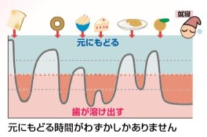 歯の周りに菌が住み着いており、共存している集合体を「マイクロビオーム」といいます。  その中には良い菌も、悪い菌も一緒に住んでいます。  お母さんから生まれたばかりの赤ちゃんのお口には、虫歯菌・歯周病菌はいません。  どこからともなくやってきて、お口の中に感染します。  生まれた後に虫歯の原因菌が人から人へ感染します。  虫歯菌の主な感染経路はお母さんとお父さんです。